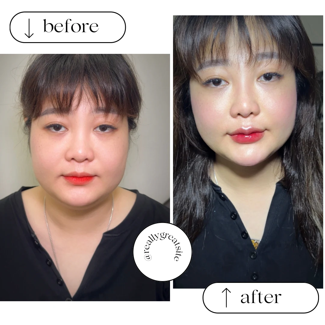 Facial balancing before-and-after comparison for a real client